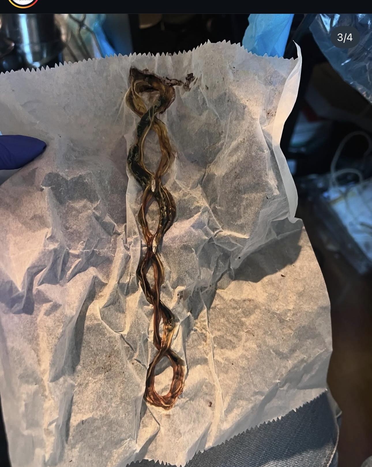 Placenta Preparation